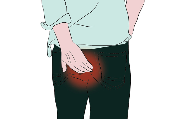 男士-痔瘡_畫板-1w適應(yīng).jpg